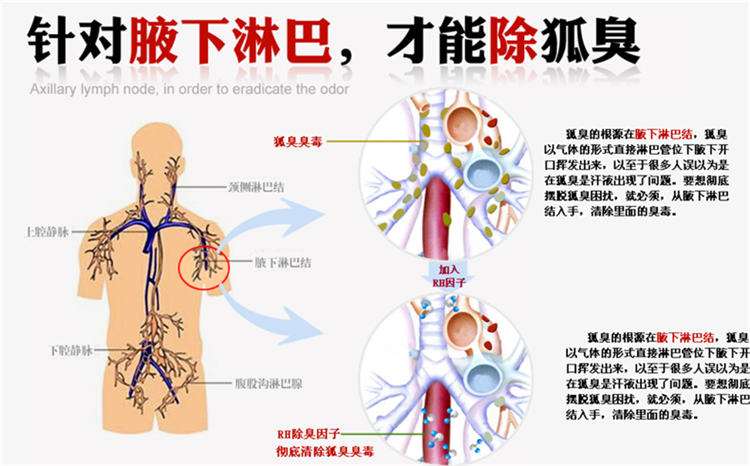 英国瑞宁宜德顿好不好